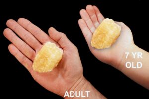 PINEAPPLE CALCITE 2 1/2" 4-7 Oz Raw Rock Mineral Solar Plexus Chakra Crystal Stone Raw Natural Specimen Reiki